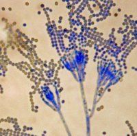 Tremorgens are produced by several mycotoxins